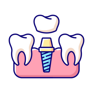 implante dental sevilla